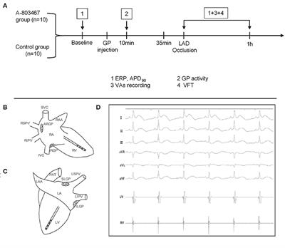 Blockade of NaV1.8 Increases the Susceptibility to Ventricular Arrhythmias During Acute Myocardial Infarction